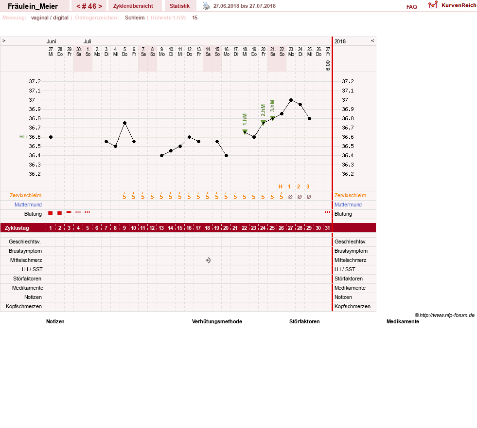 NFP-Kurve User #25664