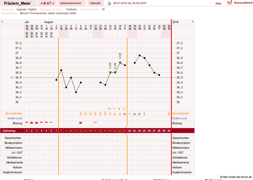NFP-Kurve User #25664