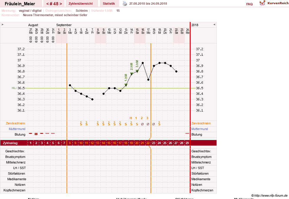 NFP-Kurve User #25664