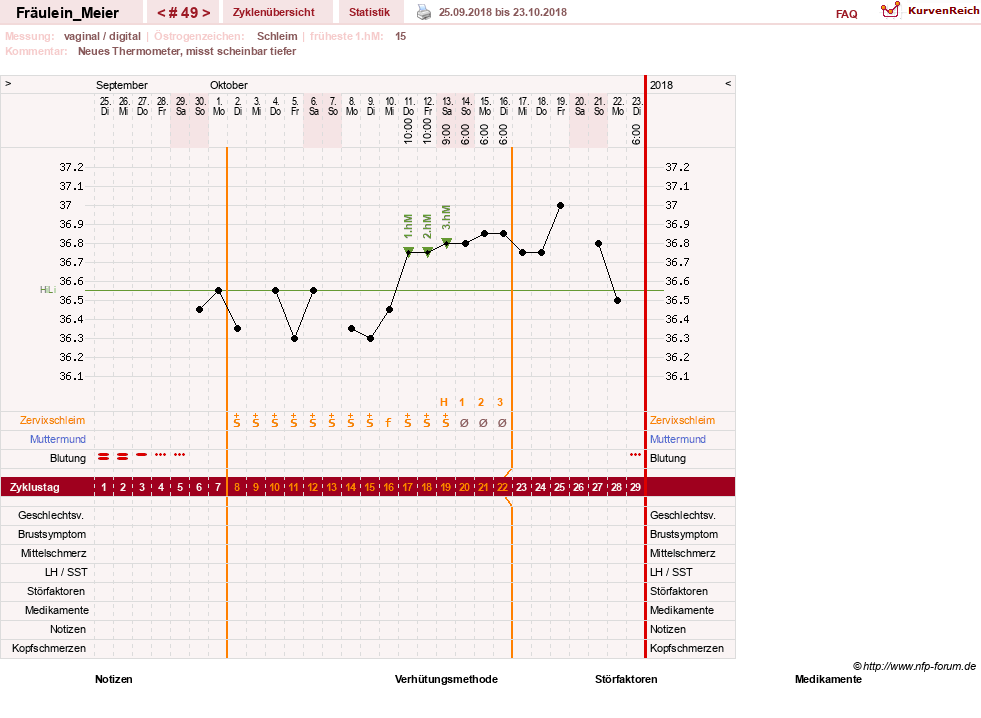 NFP-Kurve User #25664