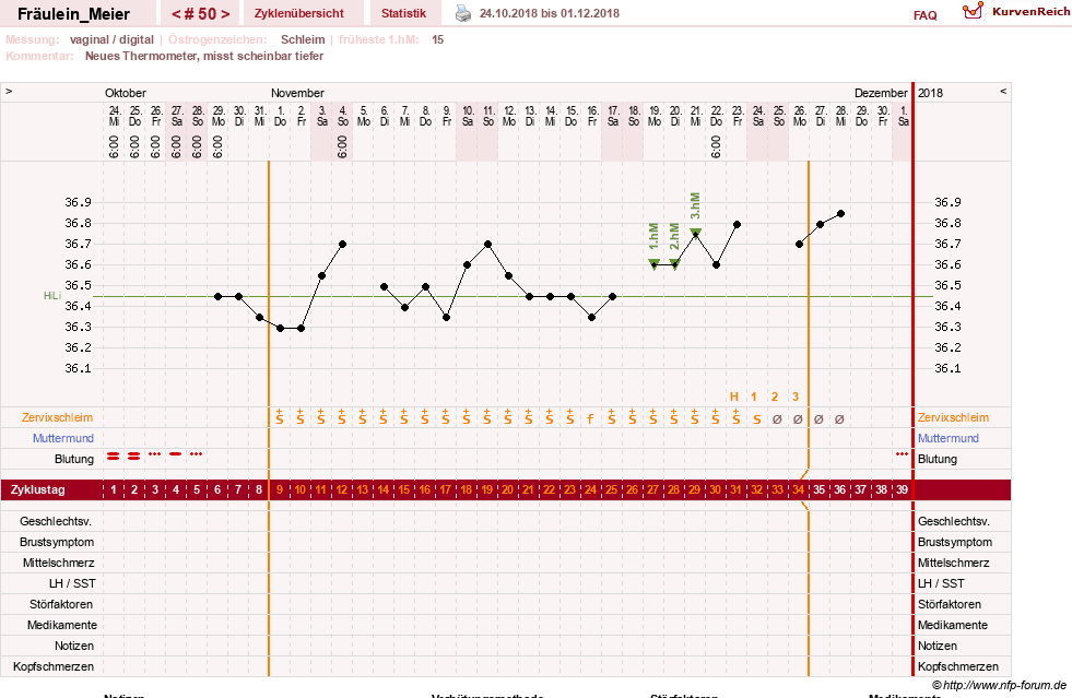 NFP-Kurve User #25664