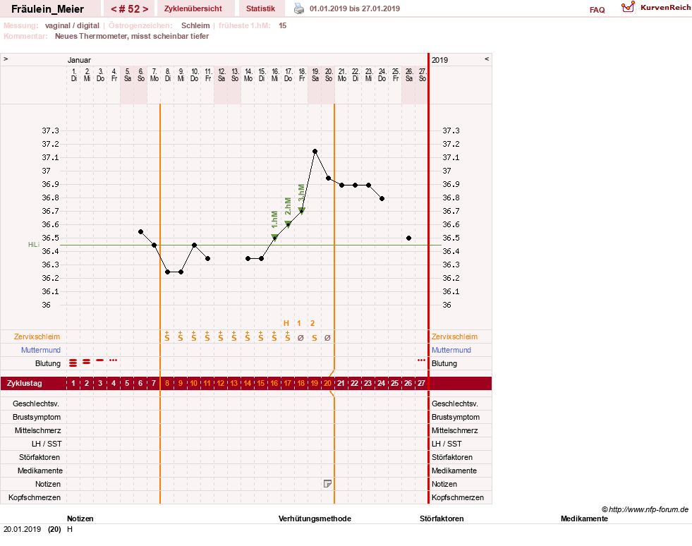 NFP-Kurve User #25664