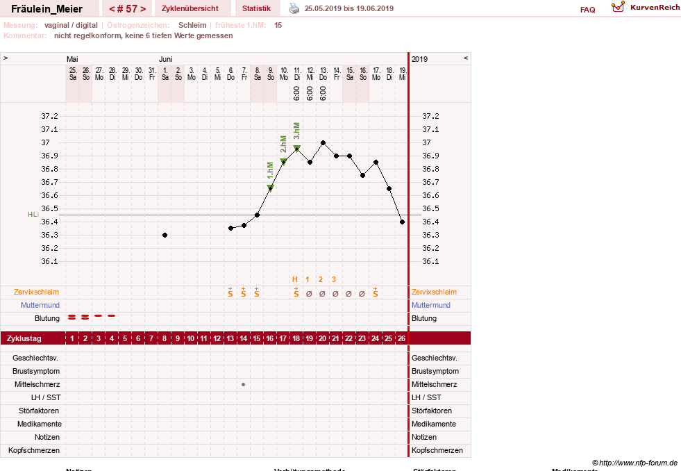 NFP-Kurve User #25664