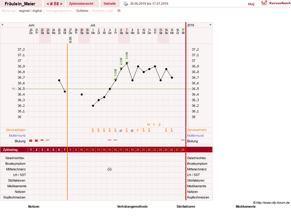 NFP-Kurve User #25664
