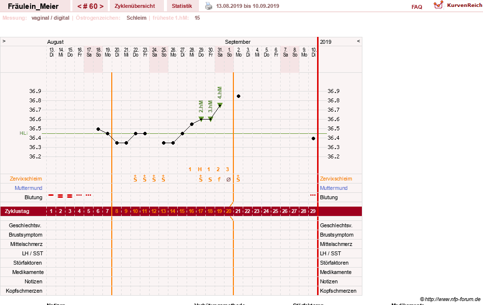 NFP-Kurve User #25664