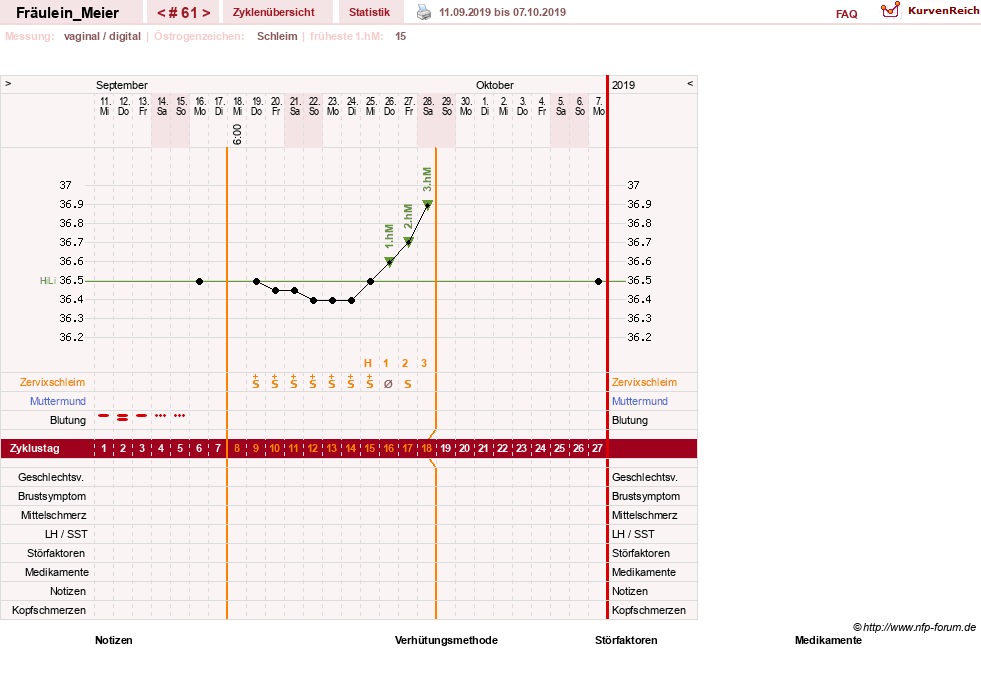 NFP-Kurve User #25664