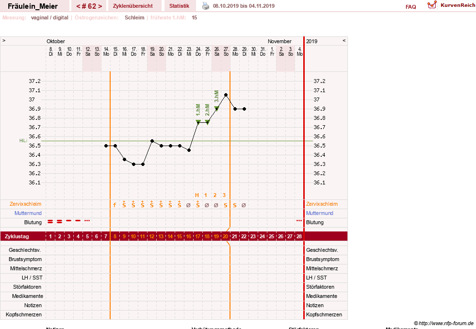NFP-Kurve User #25664