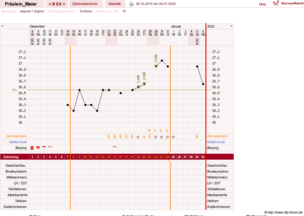 NFP-Kurve User #25664