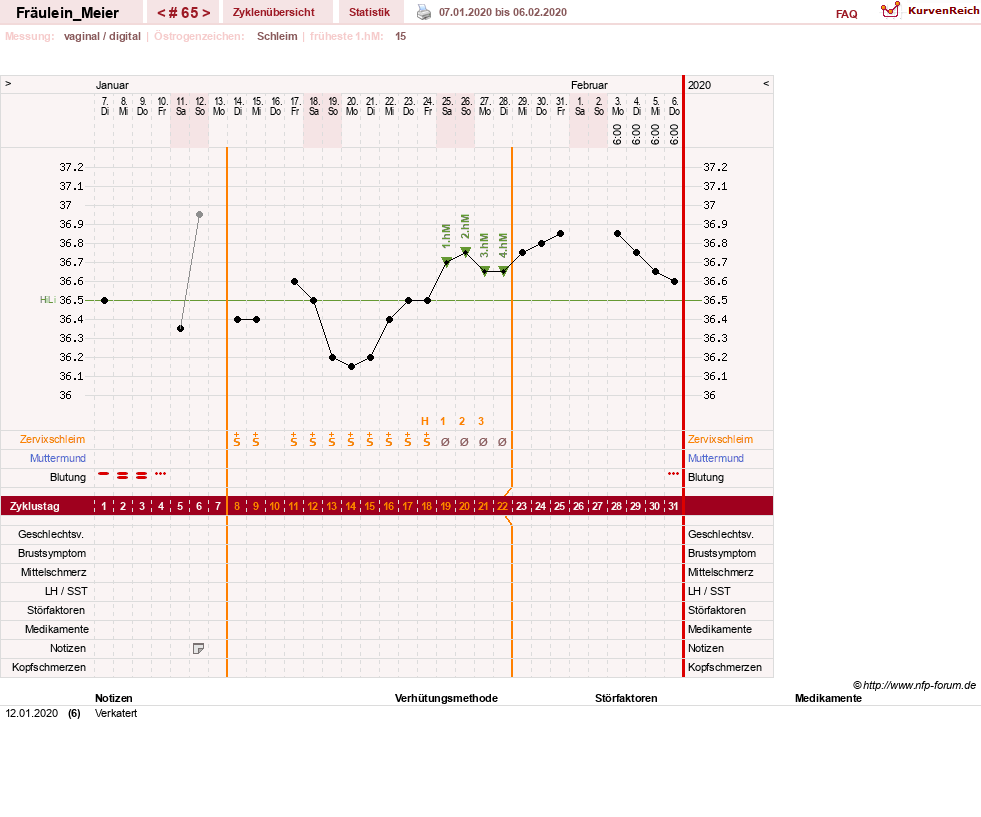 NFP-Kurve User #25664