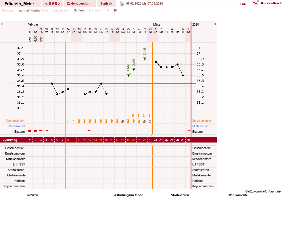 NFP-Kurve User #25664