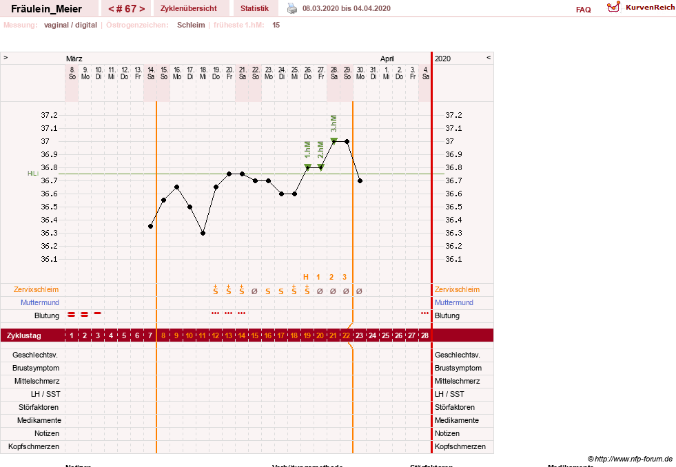 NFP-Kurve User #25664