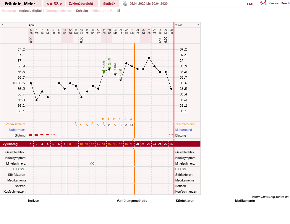 NFP-Kurve User #25664