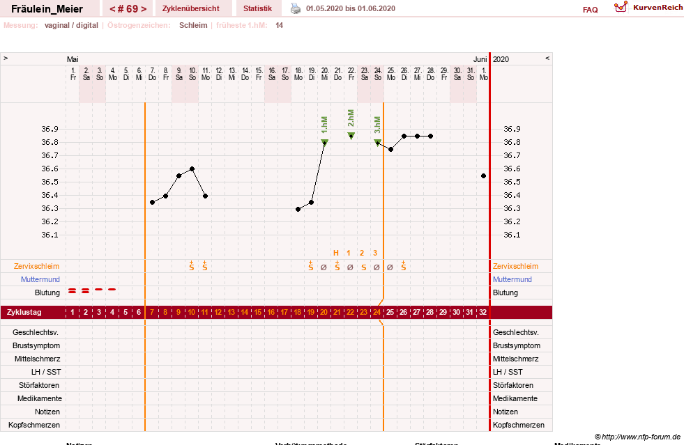 NFP-Kurve User #25664