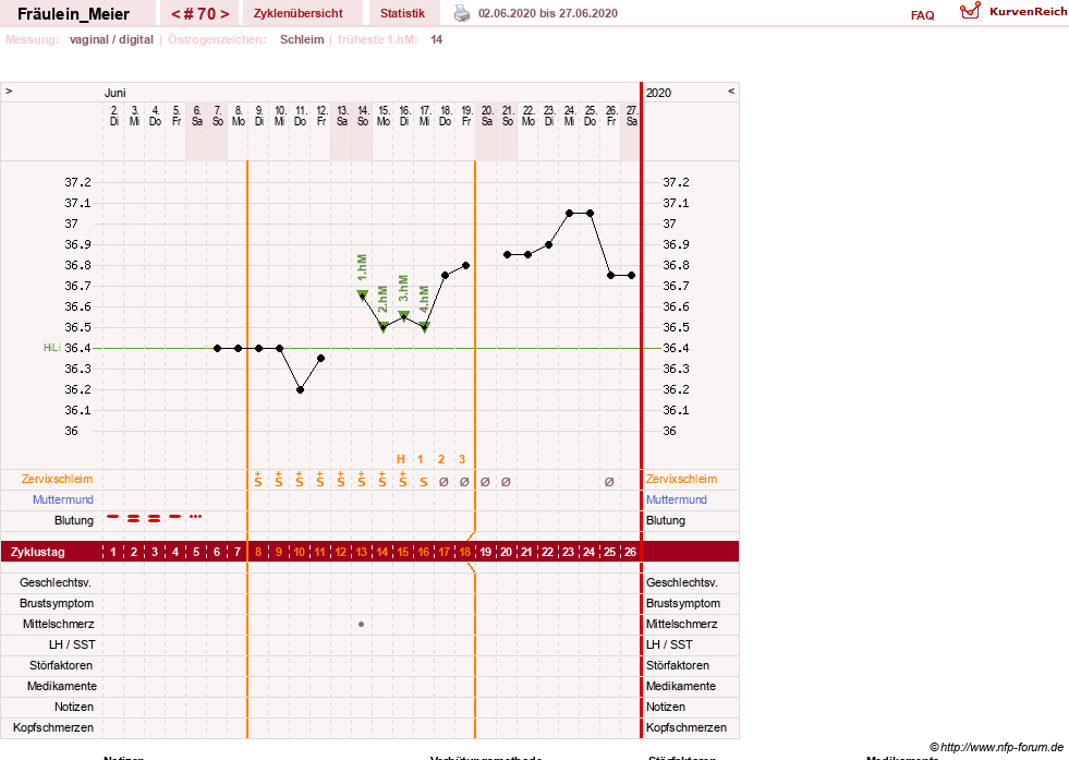 NFP-Kurve User #25664