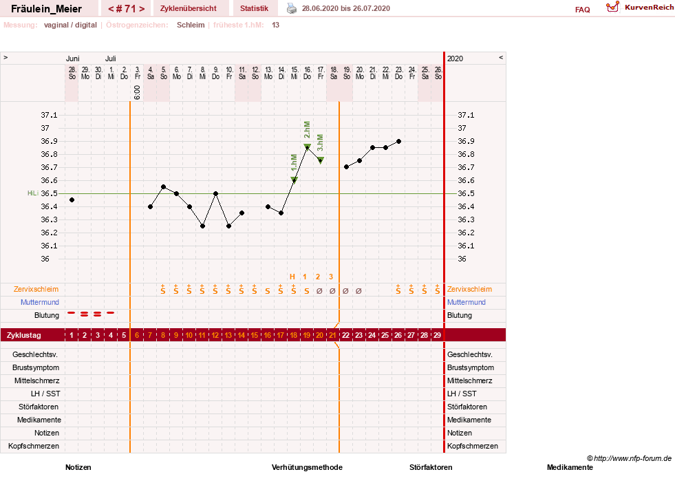 NFP-Kurve User #25664