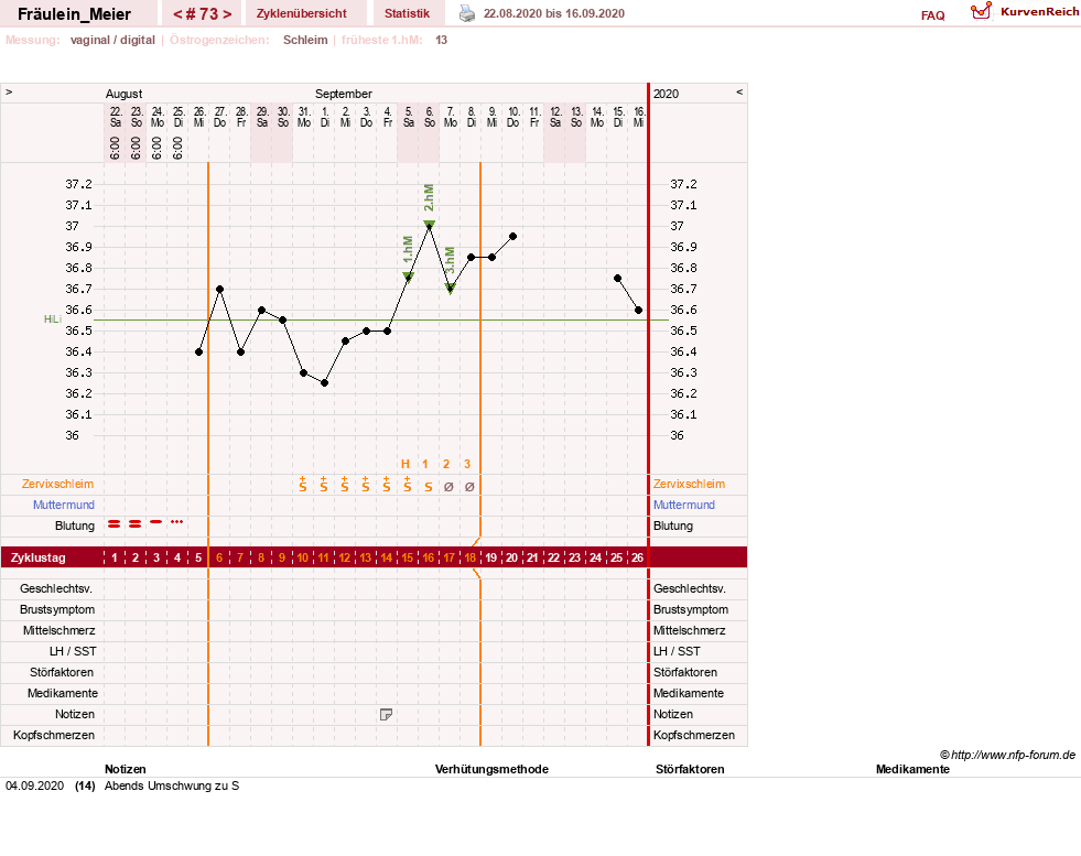 NFP-Kurve User #25664