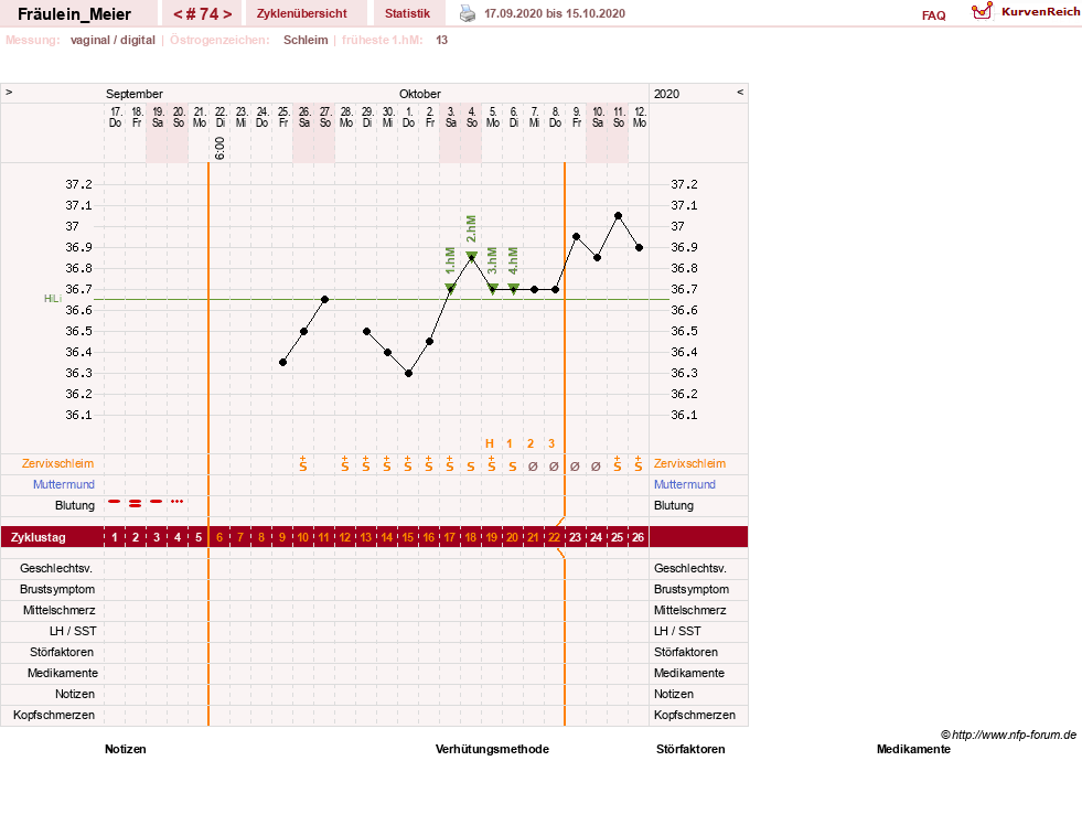 NFP-Kurve User #25664