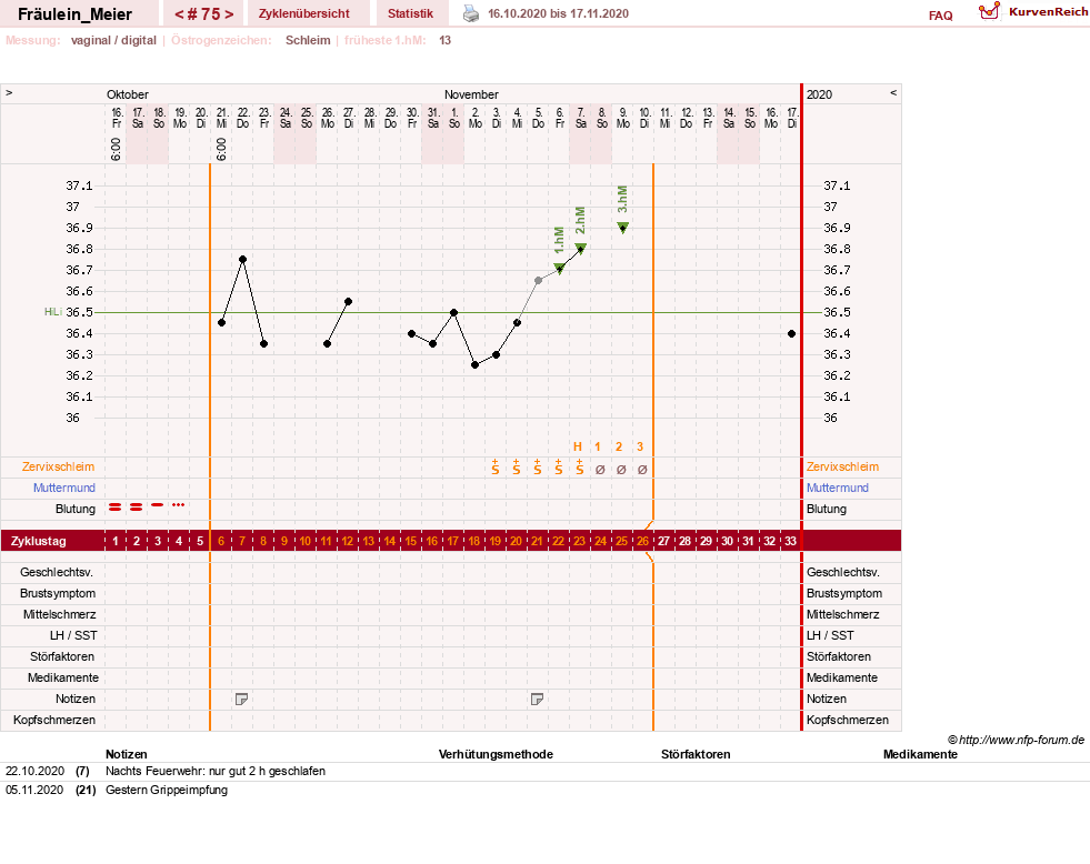 NFP-Kurve User #25664