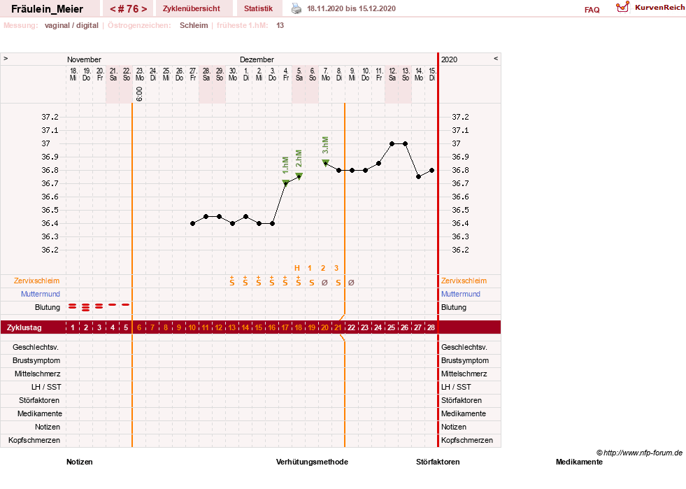 NFP-Kurve User #25664