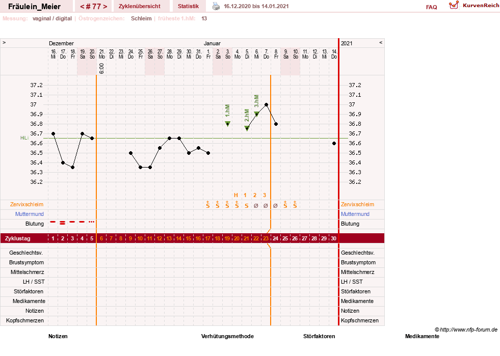 NFP-Kurve User #25664