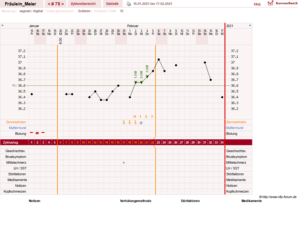 NFP-Kurve User #25664