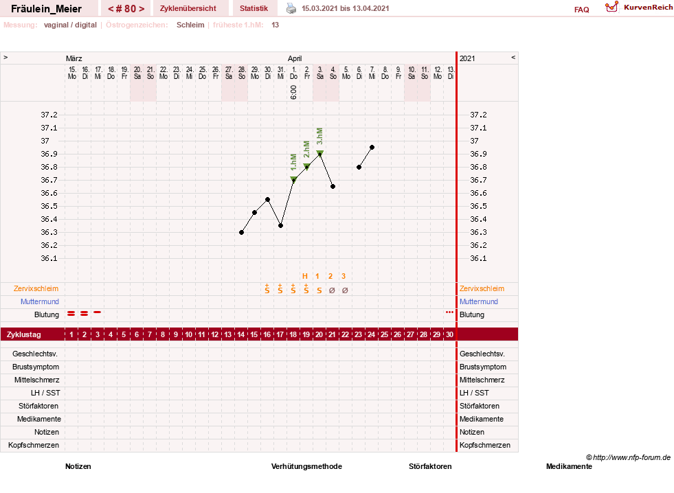 NFP-Kurve User #25664