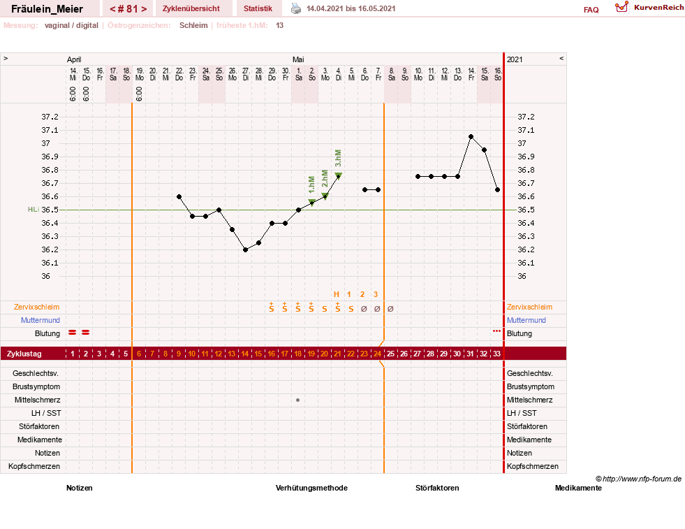 NFP-Kurve User #25664