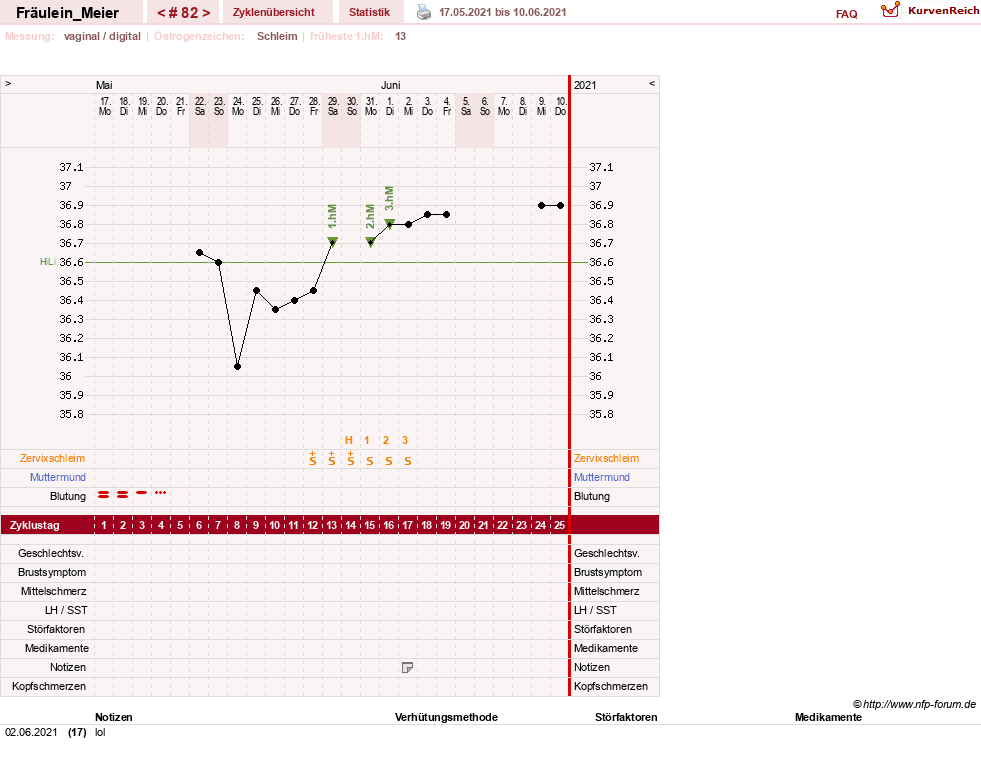 NFP-Kurve User #25664