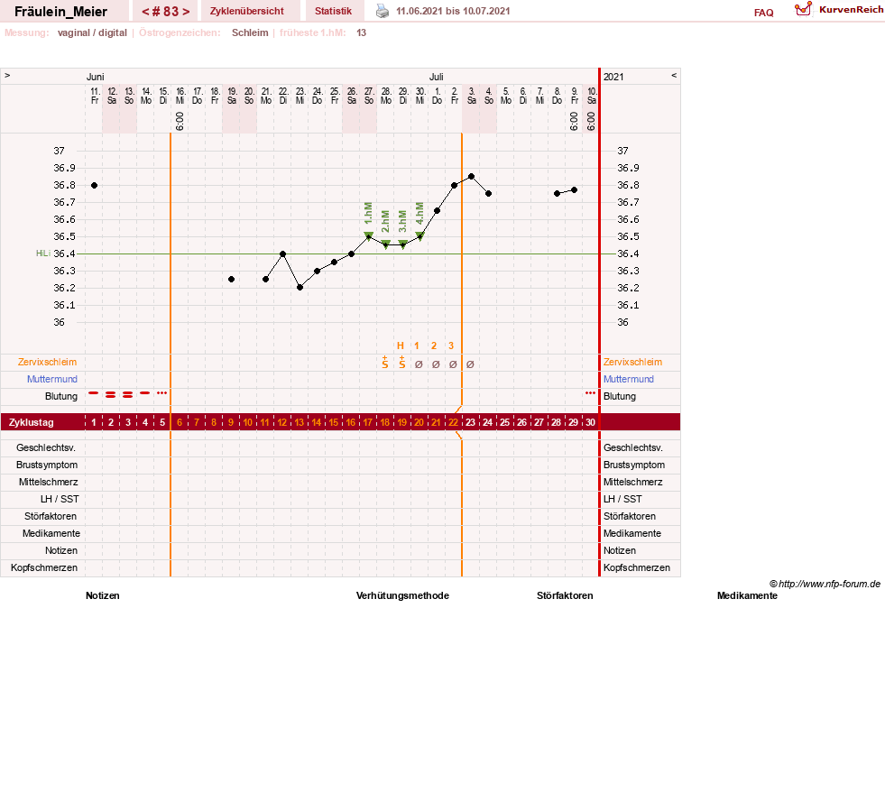 NFP-Kurve User #25664