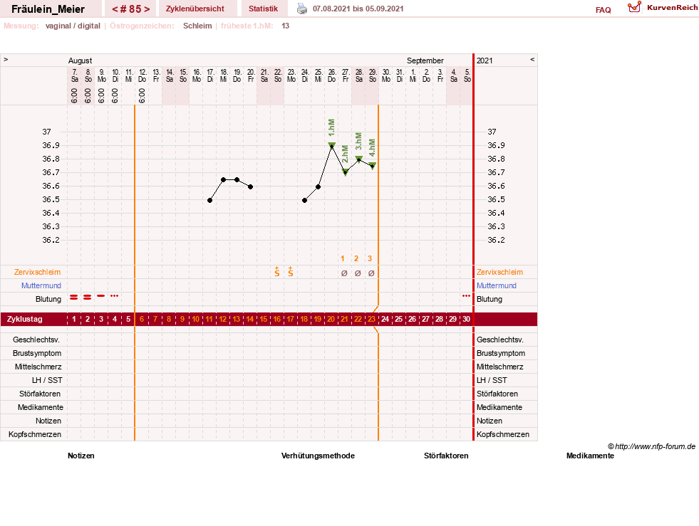 NFP-Kurve User #25664