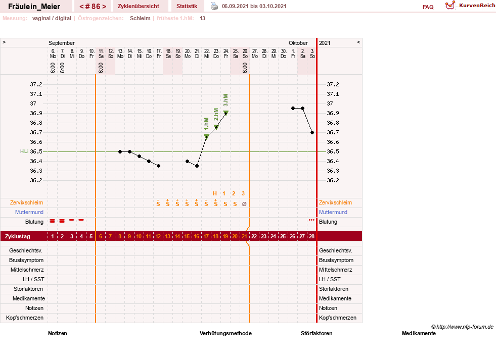 NFP-Kurve User #25664
