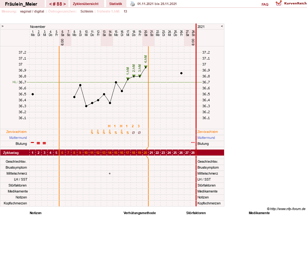 NFP-Kurve User #25664