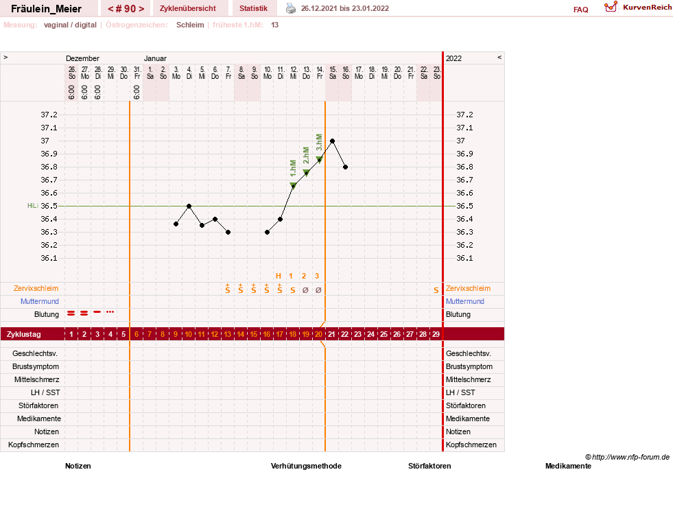 NFP-Kurve User #25664