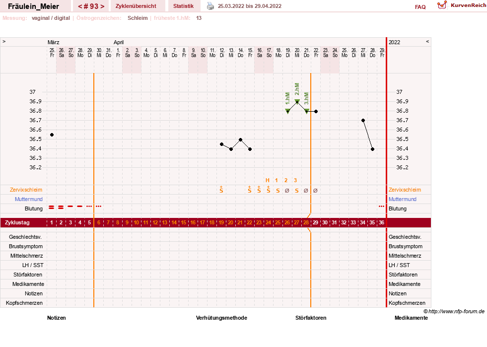 NFP-Kurve User #25664