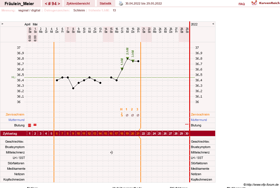 NFP-Kurve User #25664