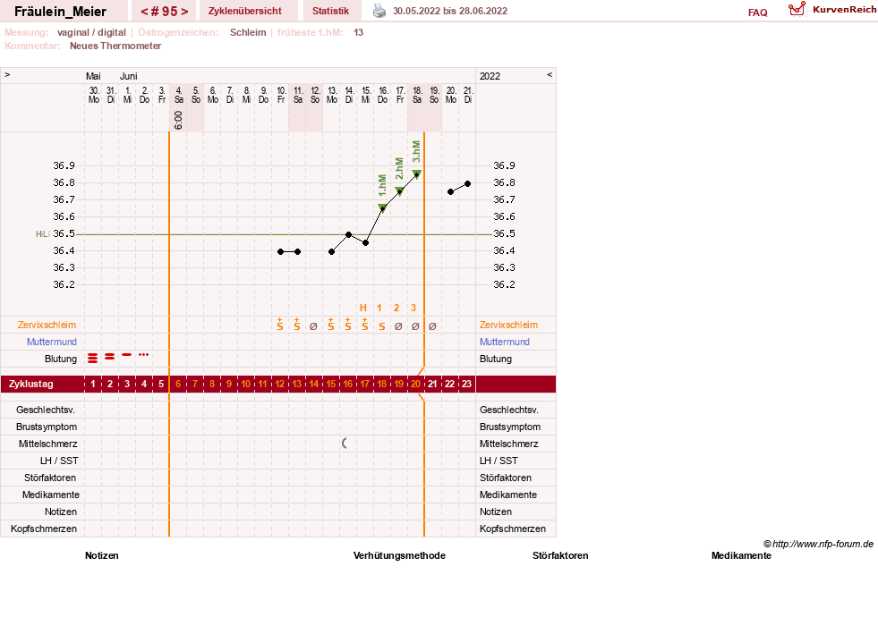 NFP-Kurve User #25664