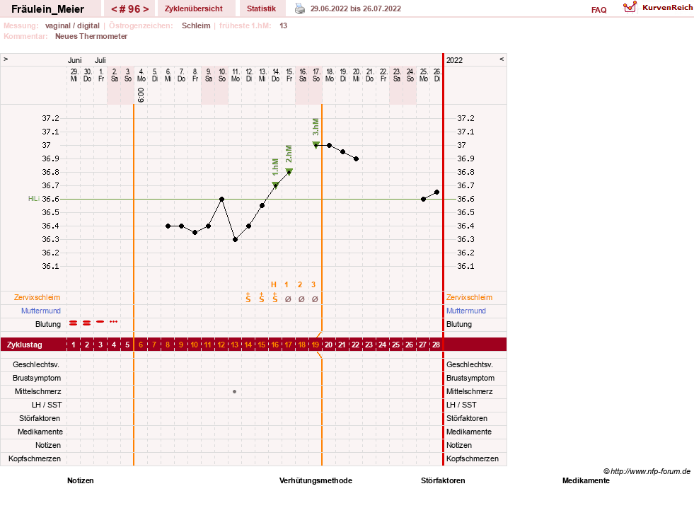 NFP-Kurve User #25664