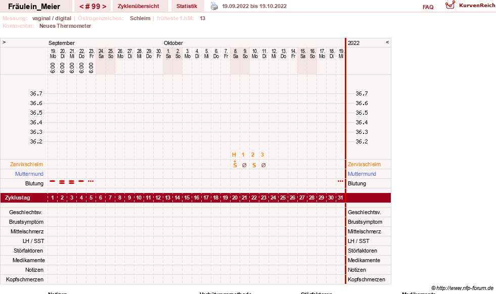 NFP-Kurve User #25664