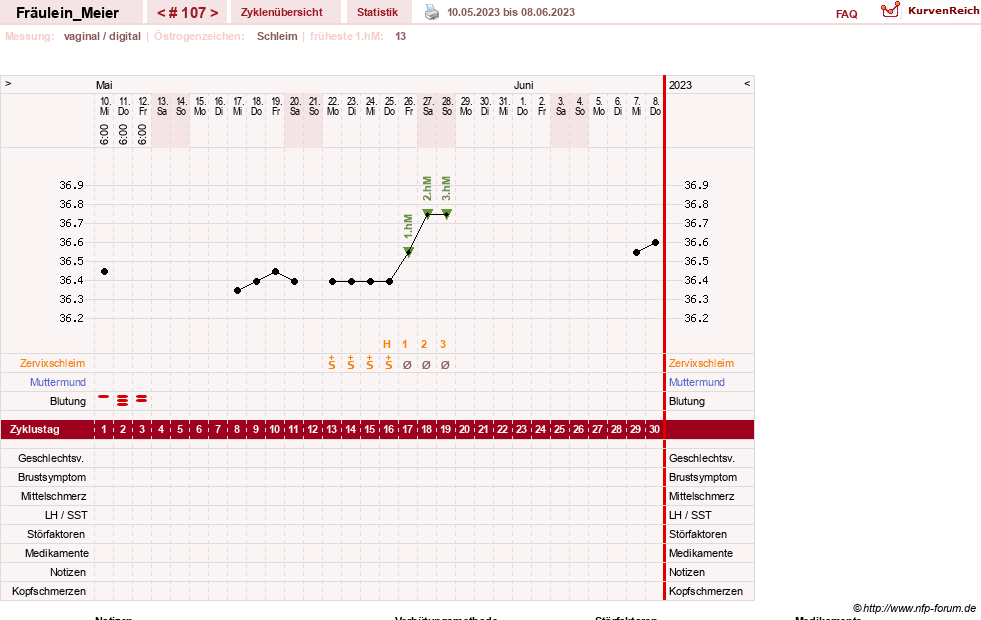 NFP-Kurve User #25664