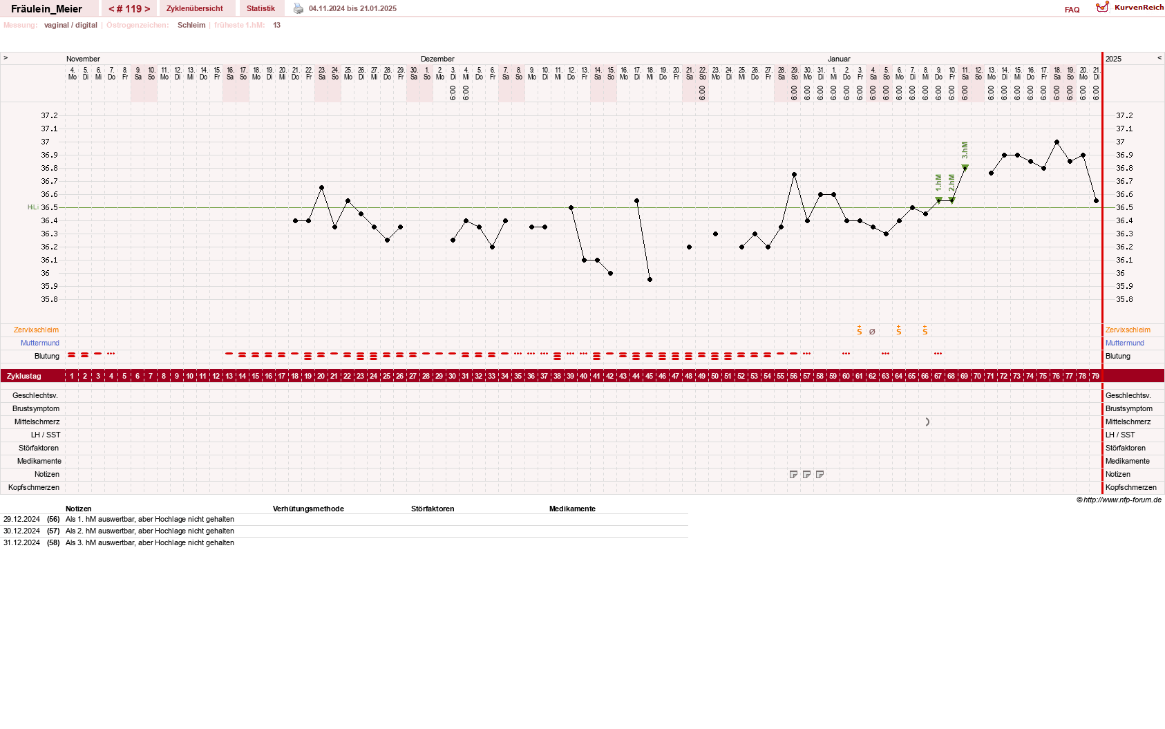 NFP-Kurve User #25664