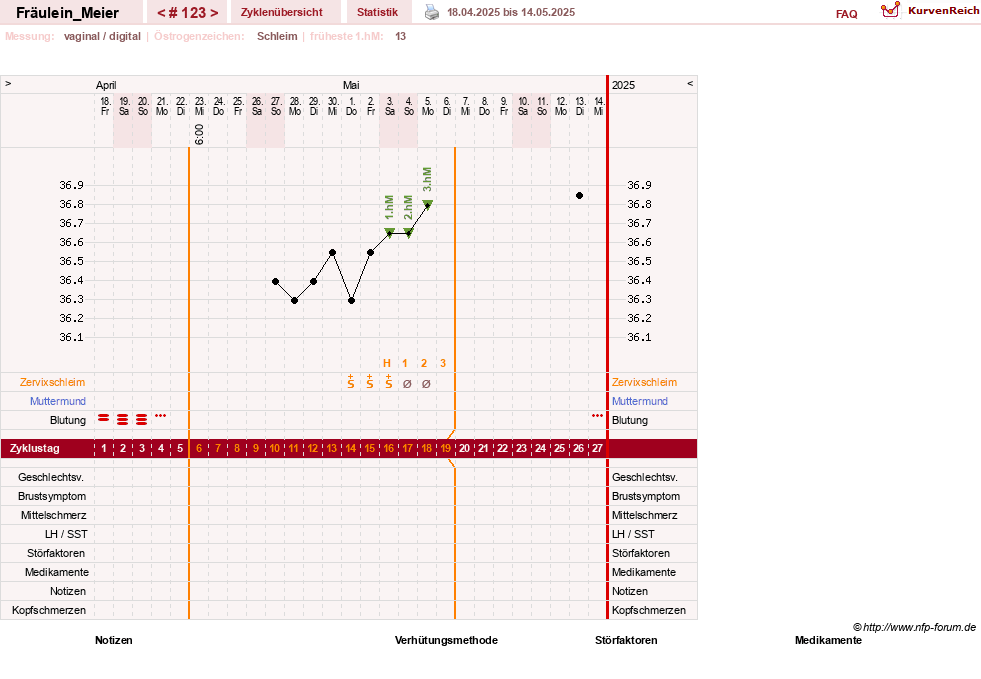 NFP-Kurve User #25664