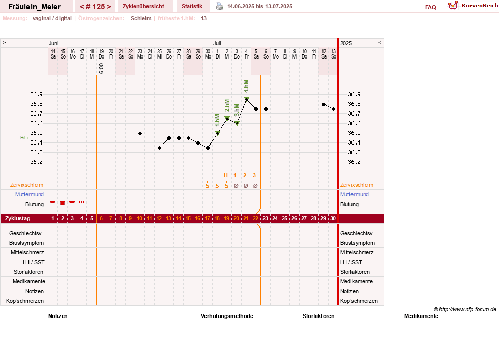 NFP-Kurve User #25664