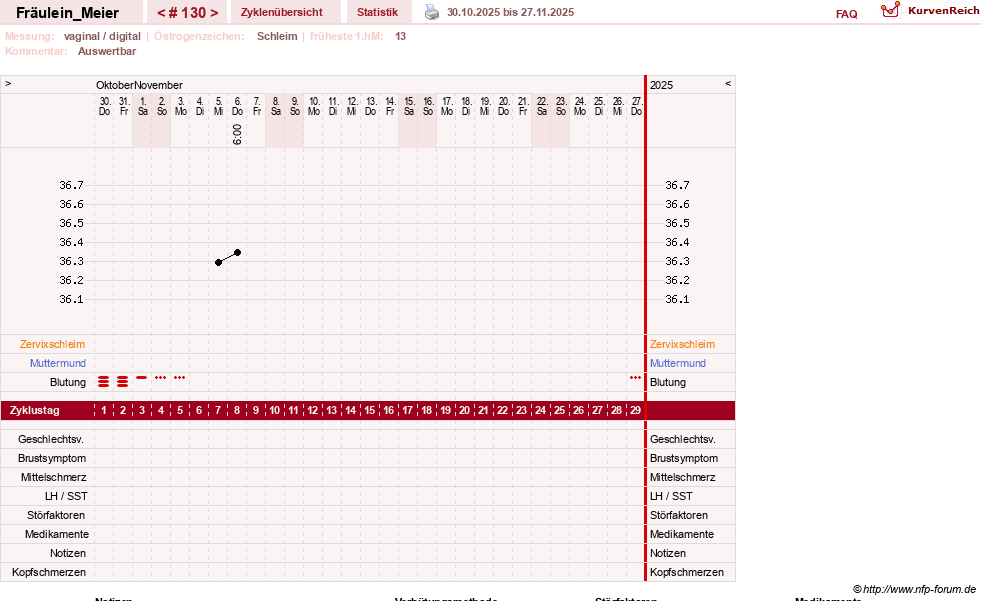 NFP-Kurve User #25664