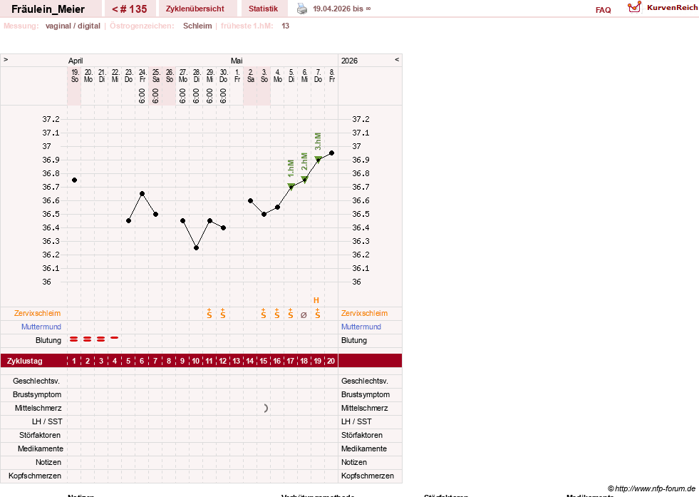 NFP-Kurve User #25664