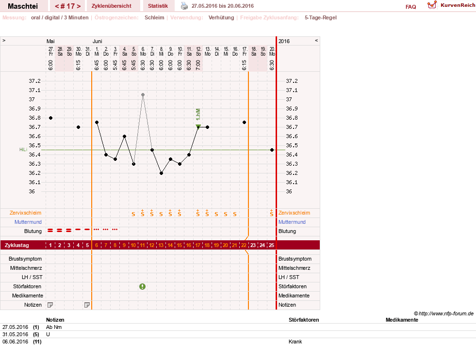 NFP-Kurve User #25702
