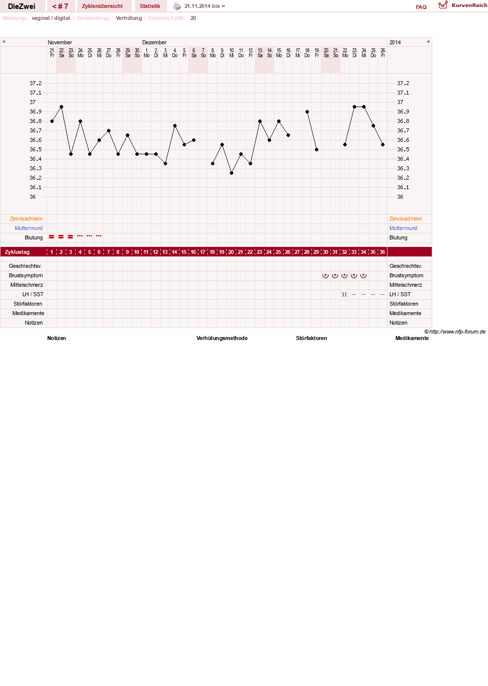 NFP-Kurve User #25822