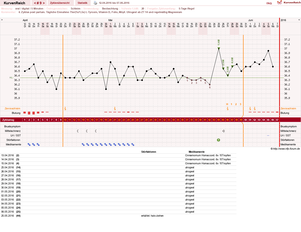 NFP-Kurve User #25900