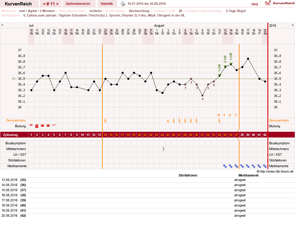 NFP-Kurve User #25900