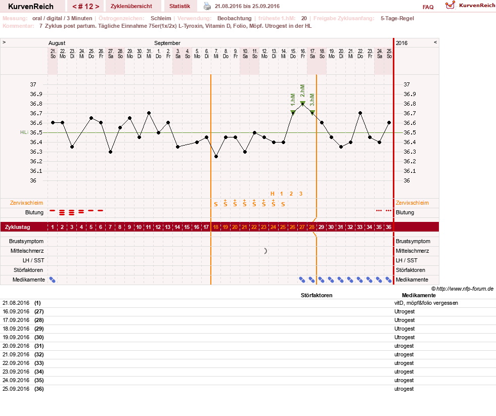 NFP-Kurve User #25900