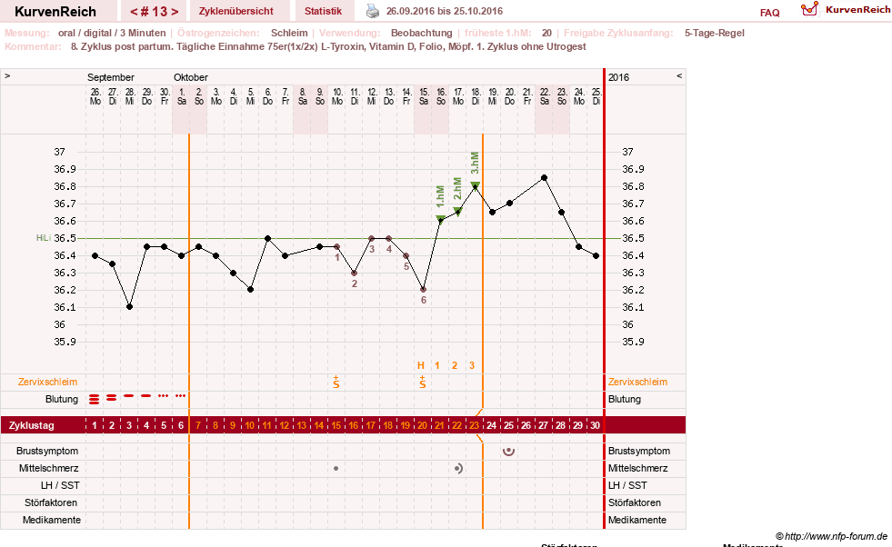 NFP-Kurve User #25900